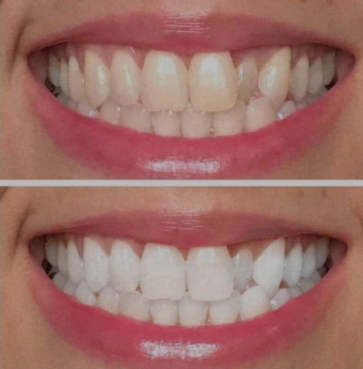 TMLL - Ultraviolet Whitening Gel